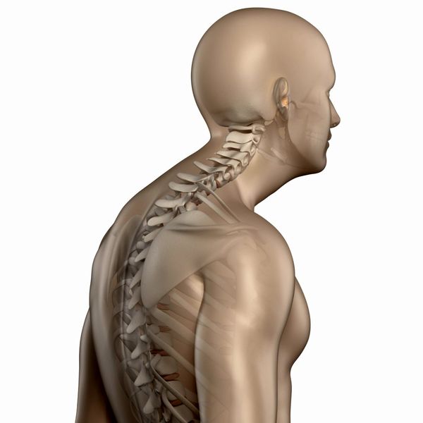 کیفوز چیست؟