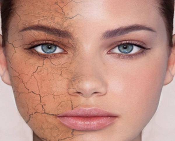 چه چیزی باعث خشکی پوست می‌شود؟