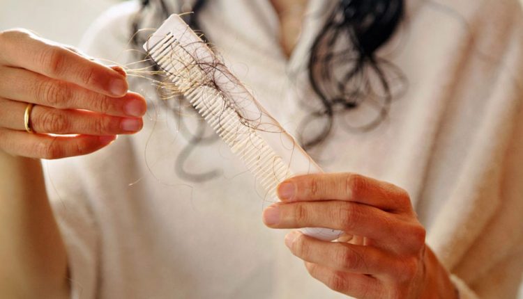 قرص‌های ضدبارداری و ریزش مو