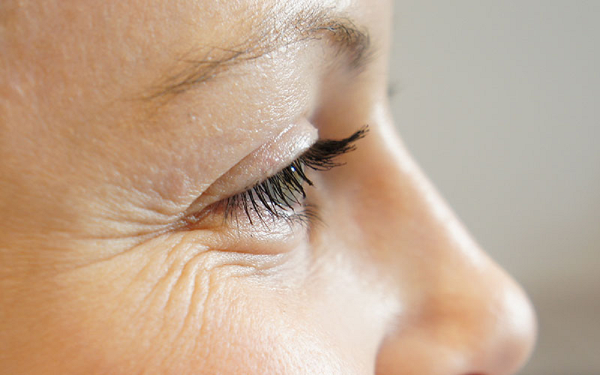 خداحافظی با چین و چروک اطراف چشم با روشهایی ساده
