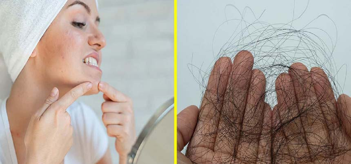 راهنمای کامل تفسیر برگه نتیجه آزمایشات هورمونی