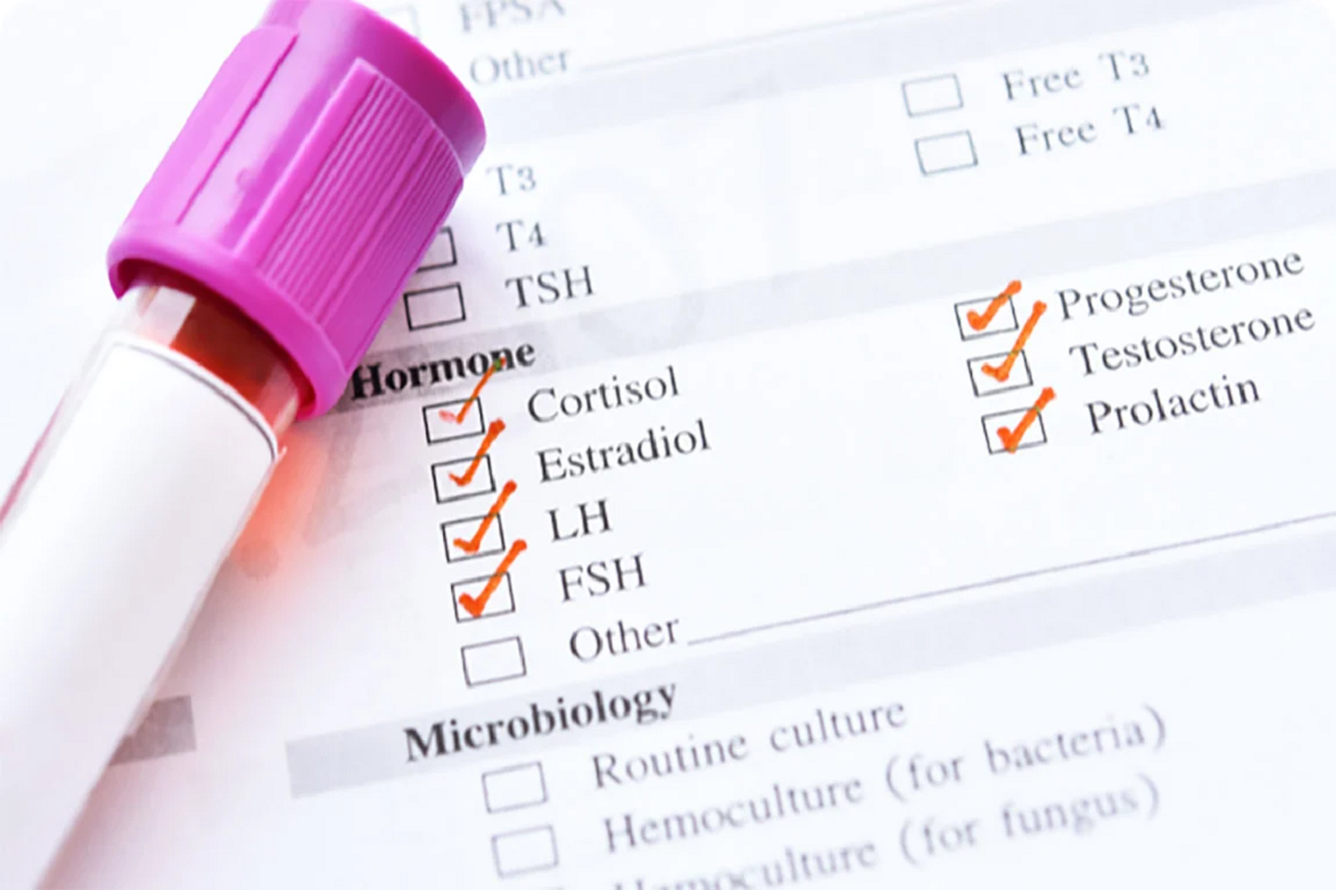 راهنمای کامل تفسیر برگه نتیجه آزمایشات هورمونی