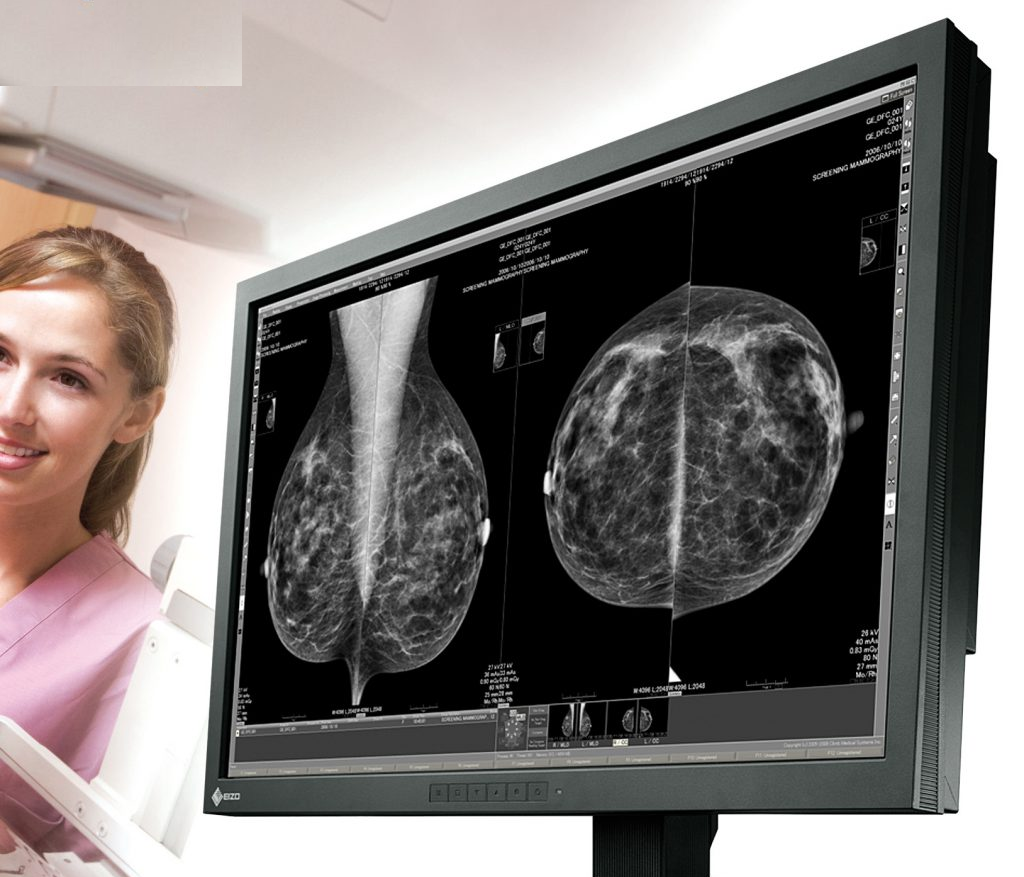 ماموگرافی چیست و با نحوه انجام آن و کاربردهای آن بیشتر آشنا شویم