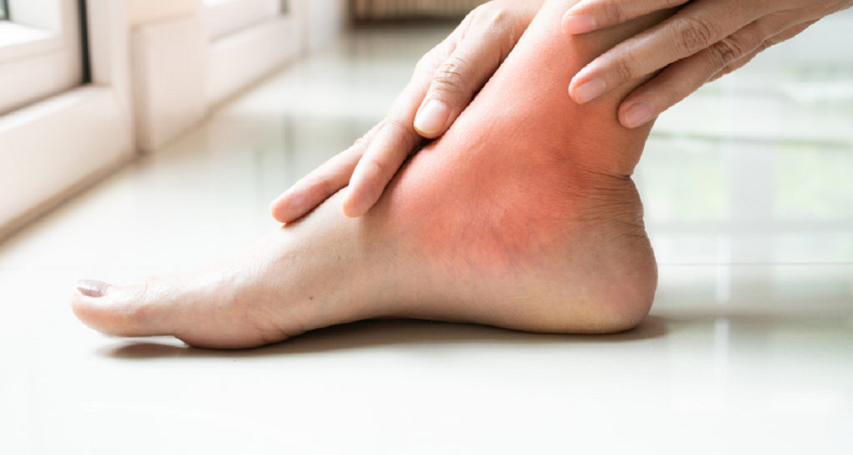 رماتیسم مفصلی یا آرتریت روماتوئید چیست و چه علائمی دارد