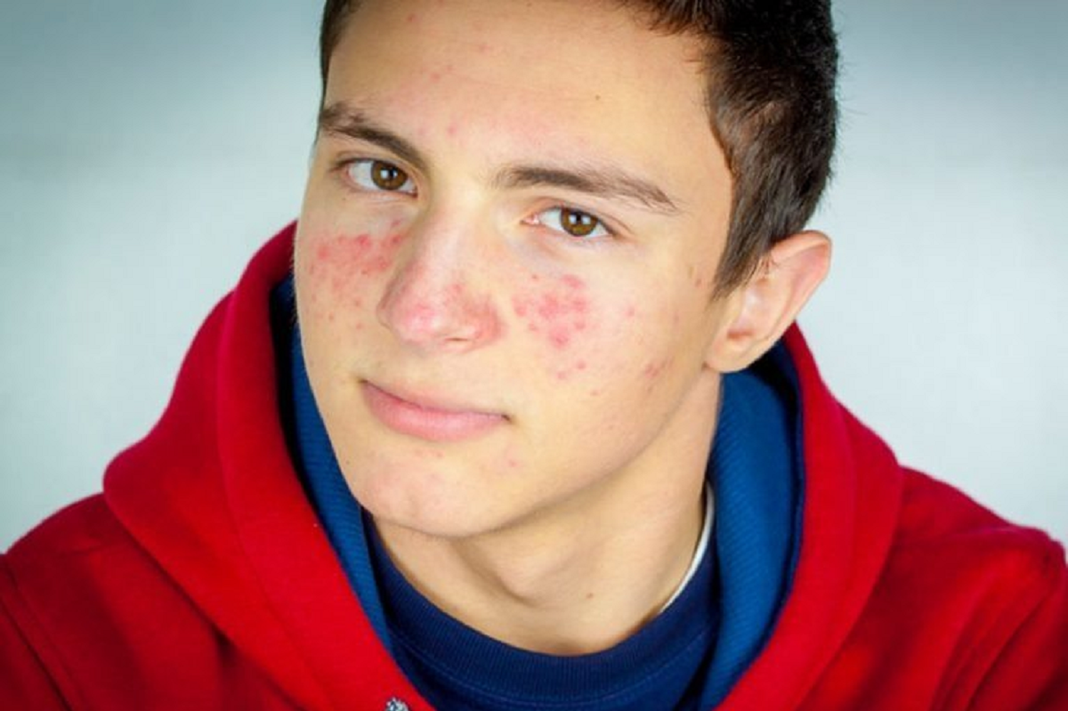 ویژگیها و فاکتورهای یک ضد آفتاب خوب