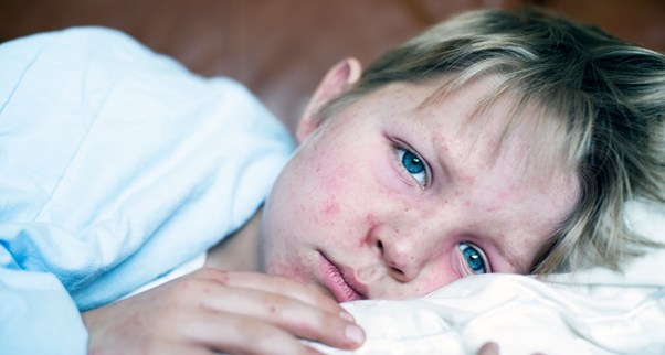 آشنایی با عفونت ها و بیماری های مزمن کودکان و راهکارهای درمانی آن