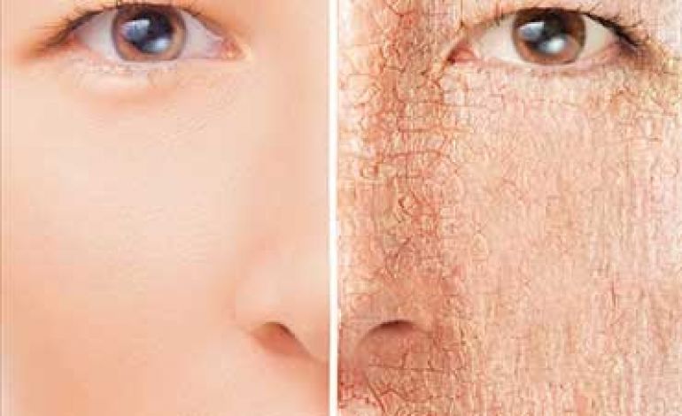 چه چیزی باعث خشکی پوست می‌شود؟