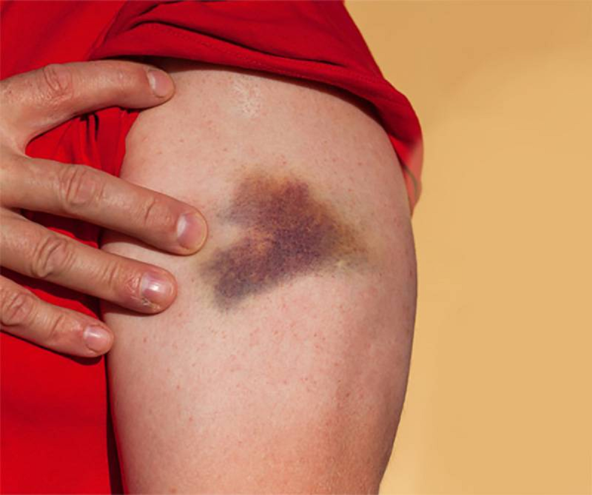 هر آنچه باید درباره اختلالات سلولی خون در انسان بدانیم