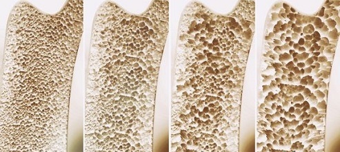 گشنیز و خواص خارق العاده آن