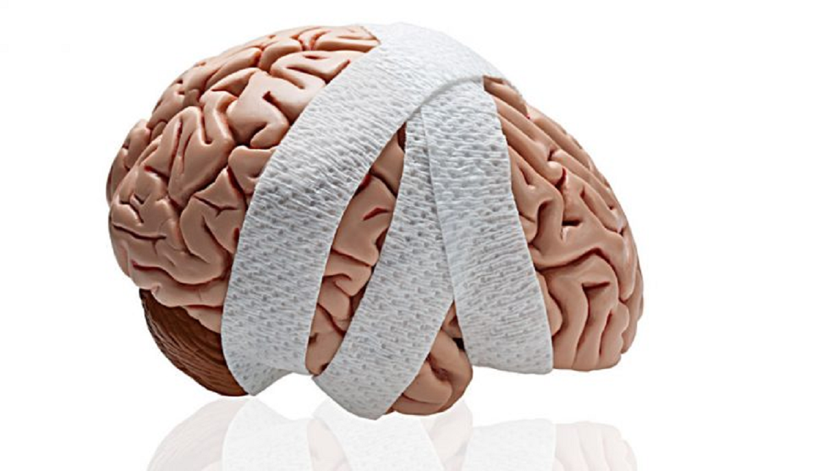 مهم‌ترین بیماری های مغز و اعصاب که باید بشناسید