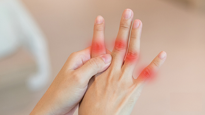 آنچه باید درباره بیماری نقرس بدانید