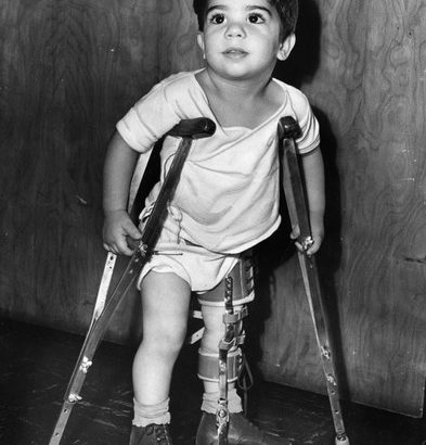 پولیومیلیت یا فلج اطفال