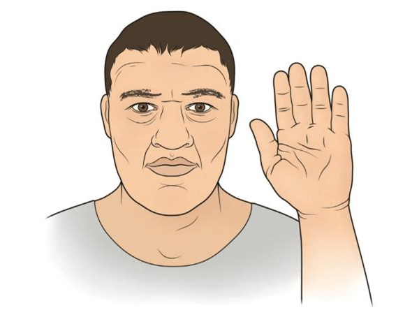 آکرومگالی و راه های درمان