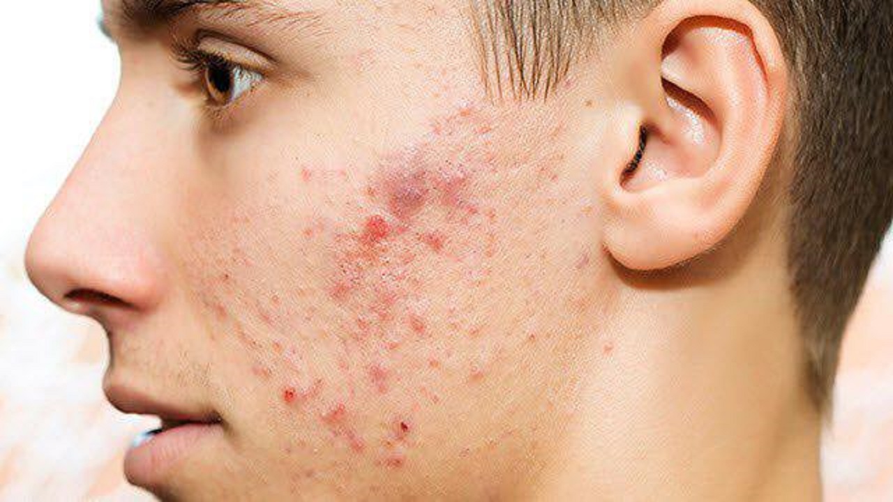 گیاه روناس و فواید آن
