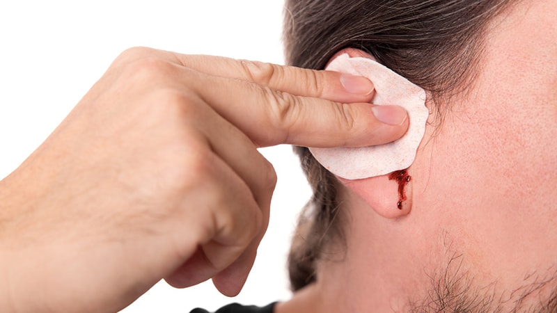 از علت تا درمان پارگی پرده گوش
