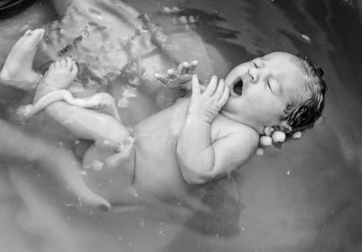 زایمان در آب