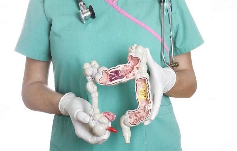 همه چیز درباره آپاندیس