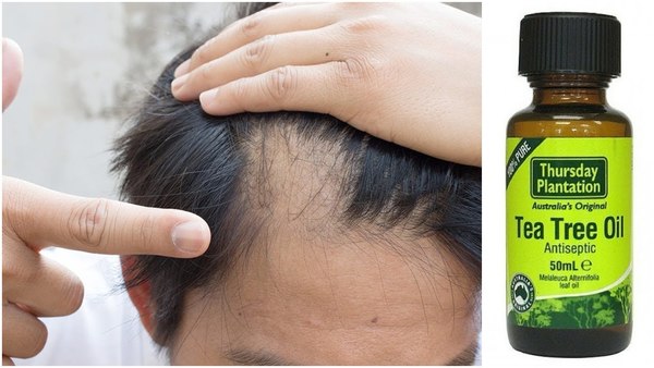 گیاه درخت چای چیست و خواص درمانی روغن آن چیست؟