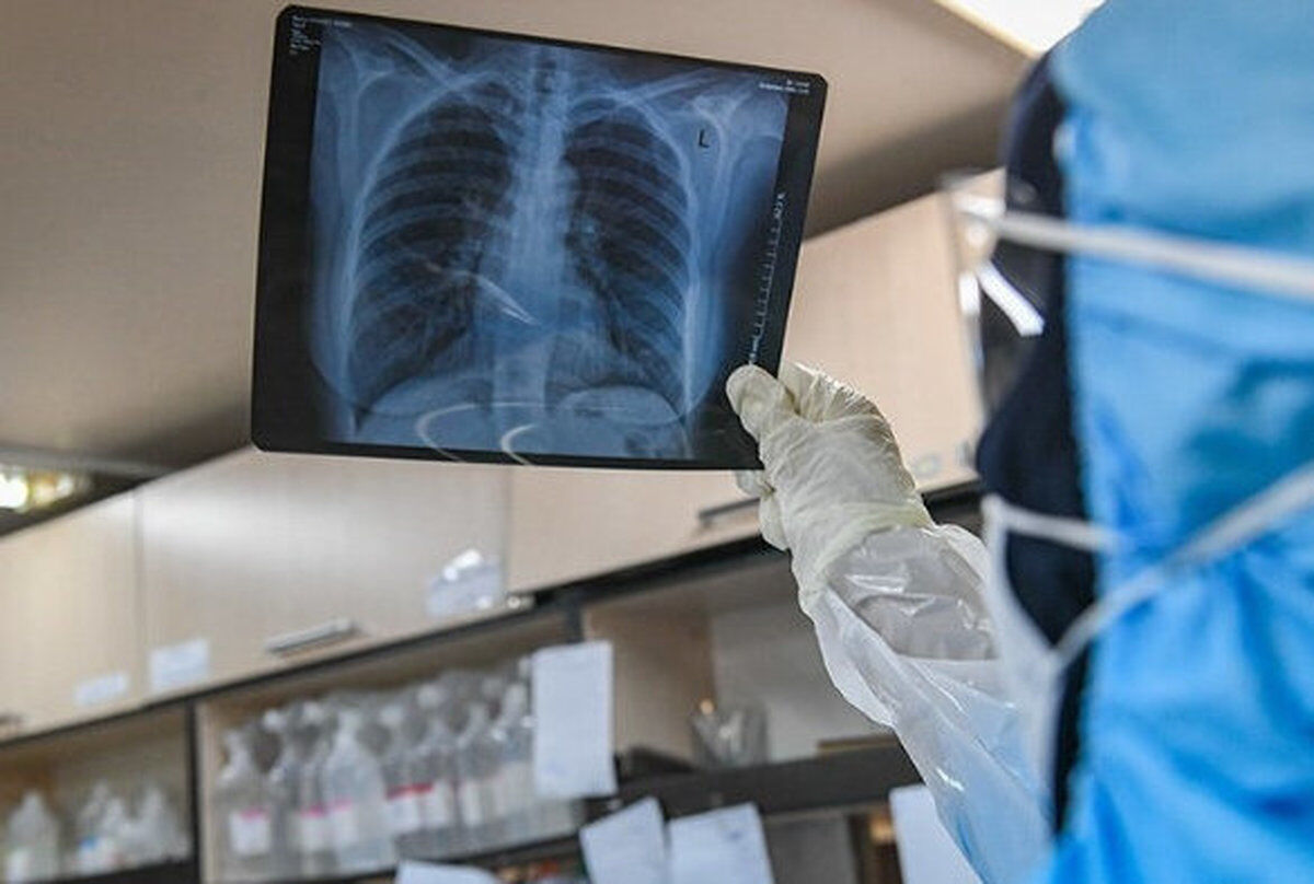 آخرین اخبار مربوط به Covid19 در ایران و جهان