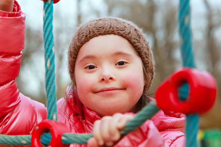 انواع سندروم داون، علت، علائم، تشخیص و درمان آن