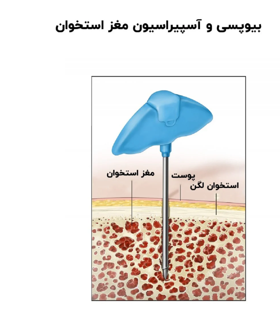 تشخیص سرطان از طریق آزمایش خون و تفسیر آن