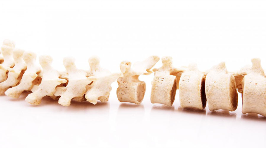 راجع به اسپینا بیفیدا چه میدانید؟