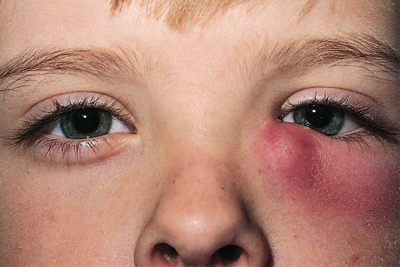 همه جیز راجع به داکرایوسیتیت