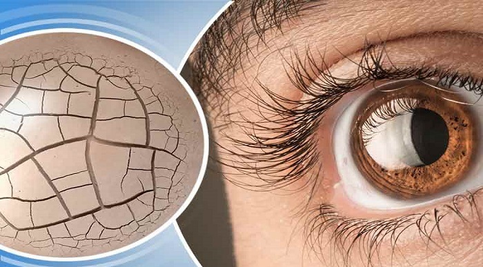 راجع به سندروم شوگرن چه میدانید؟