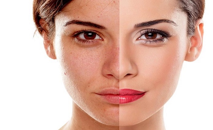 خواص اعجاب انگیز گلاب بر روی پوست