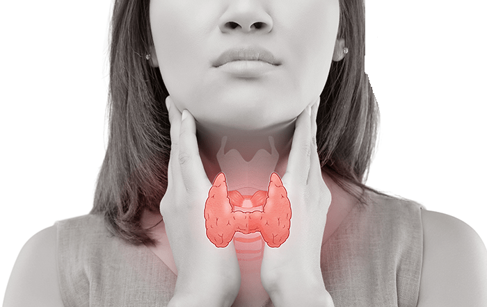 همه چیز درباره پرکاری تیروئید‎