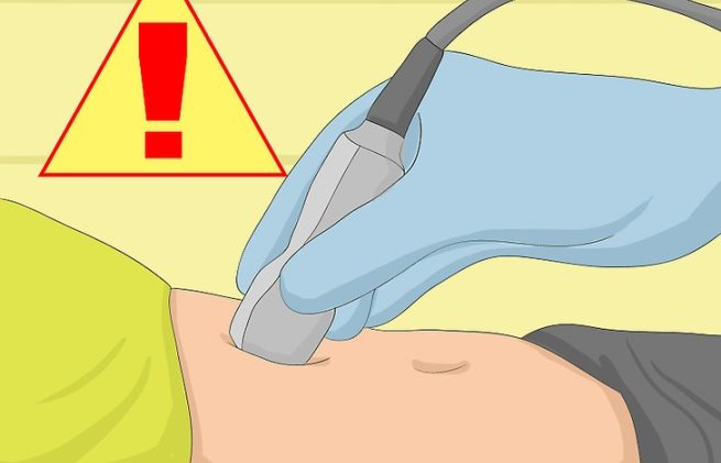 هرآنچه که باید راجع به بارداری خارج از رحم بدانیم