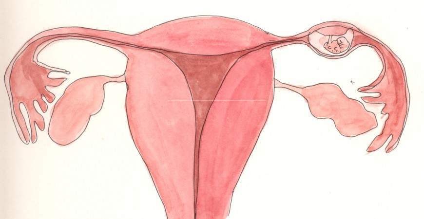 حاملگی خارج از رحم چیست؟