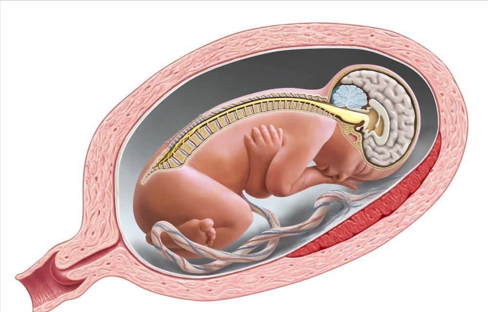 راجع به اسپینا بیفیدا چه میدانید؟