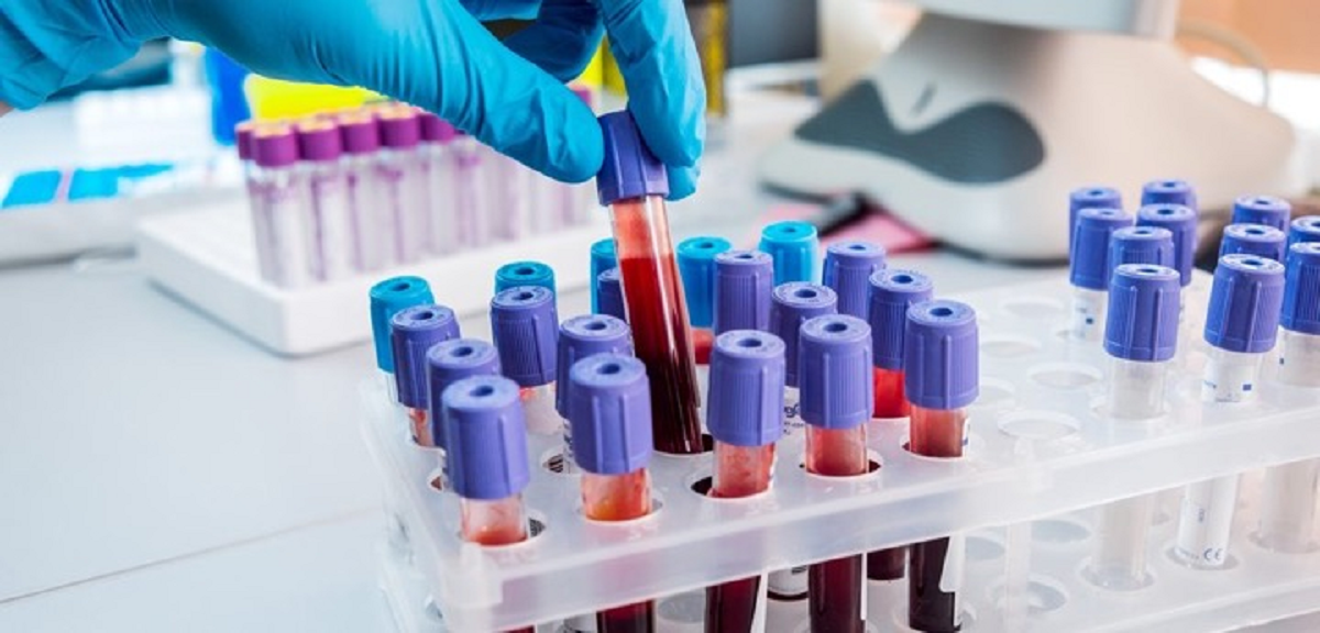 هر آنچه باید درباره اختلالات سلولی خون در انسان بدانیم