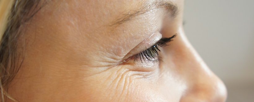 رابطه استرس و سلامت پوست