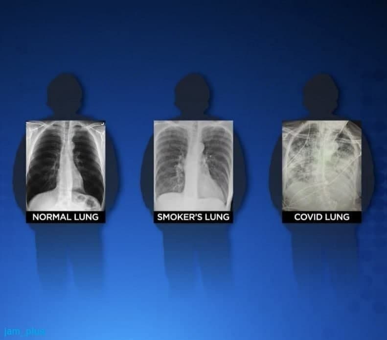 آخرین اخبار مربوط به کرونا در ایران و جهان در ماه دی