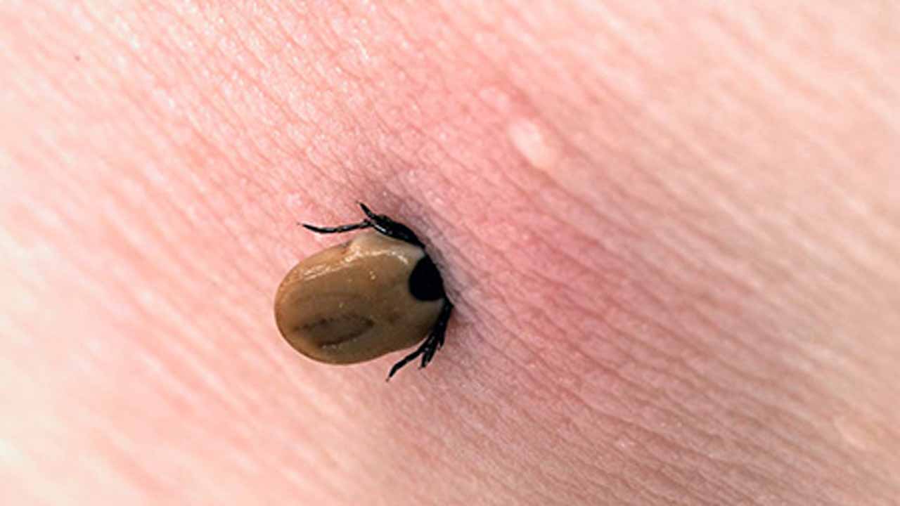 راه‌های جلوگیری از نیش پشه در کودکان