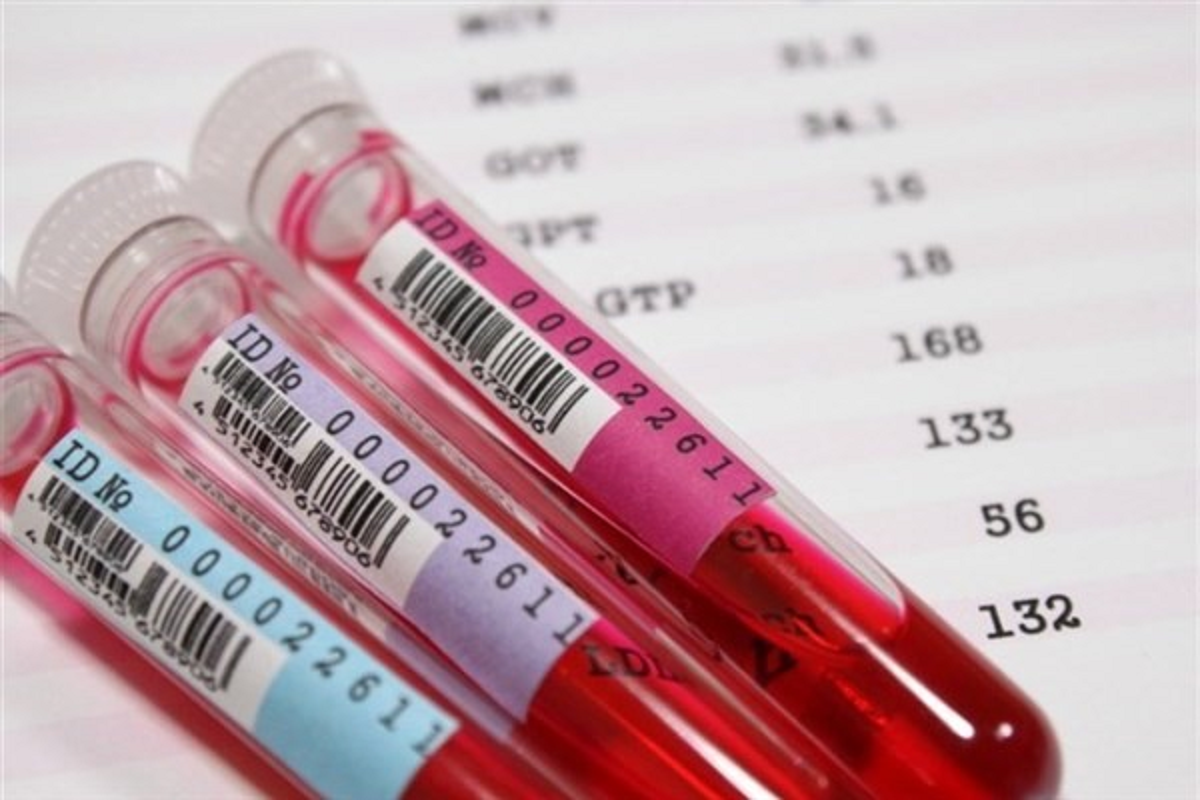 تشخیص سرطان از طریق آزمایش خون و تفسیر آن