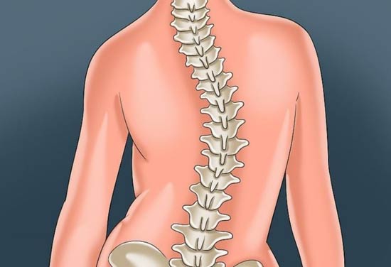 اسکولیوز یا انحراف ستون فقرات
