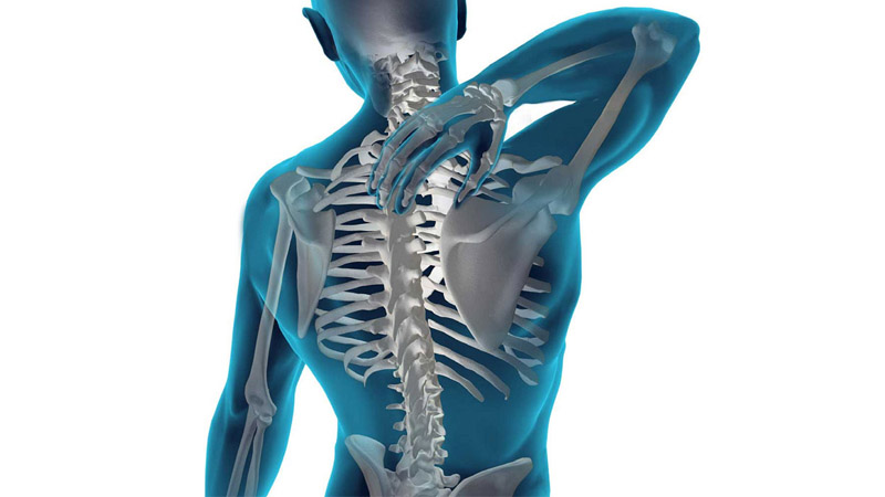 اسکولیوز یا انحراف ستون فقرات