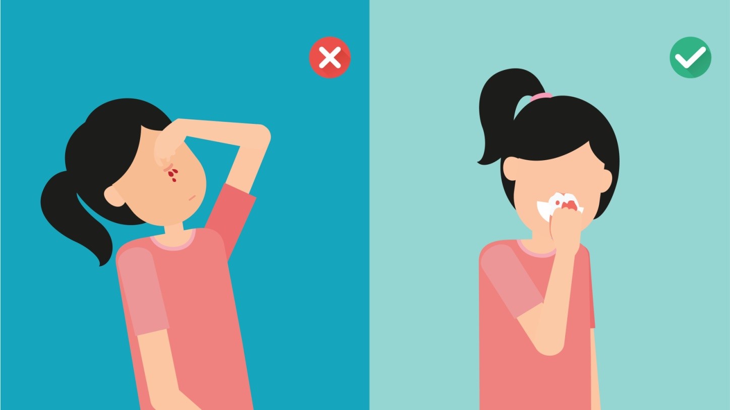 خونریزی بینی در کودکان