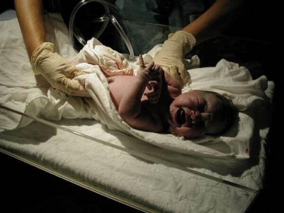 راجع به تست آپگار چه میدانید؟