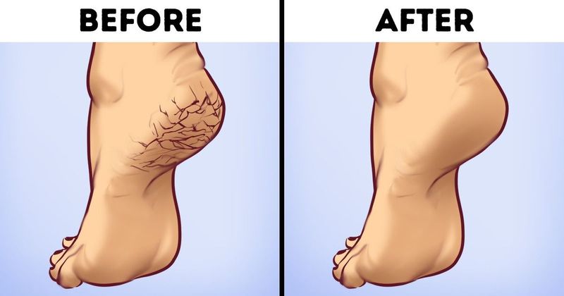 خواص اعجاب انگیز گلاب بر روی پوست