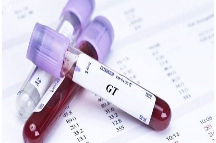 آزمایش گلوکز چیست و چرا انجام میشود؟