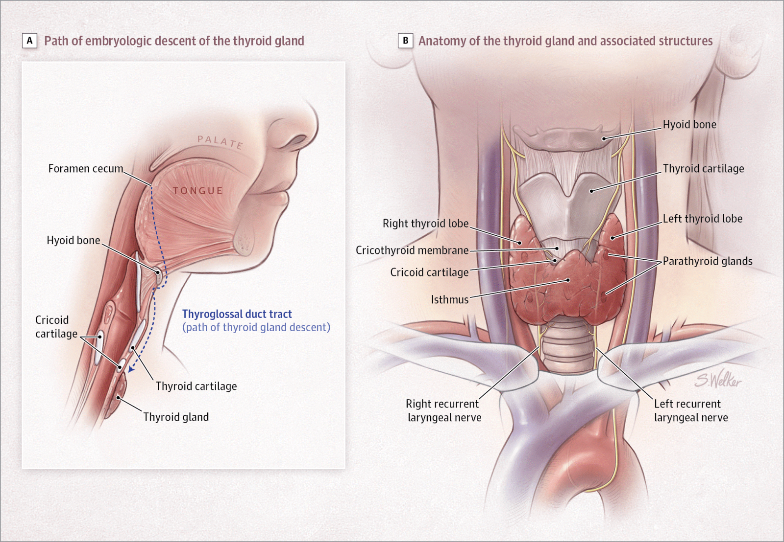 تشخیص و درمان گواتر