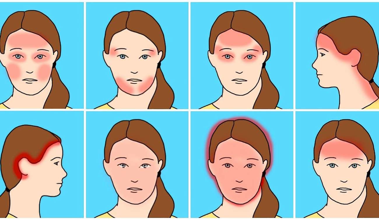 درمان سردرد با طب سنتی