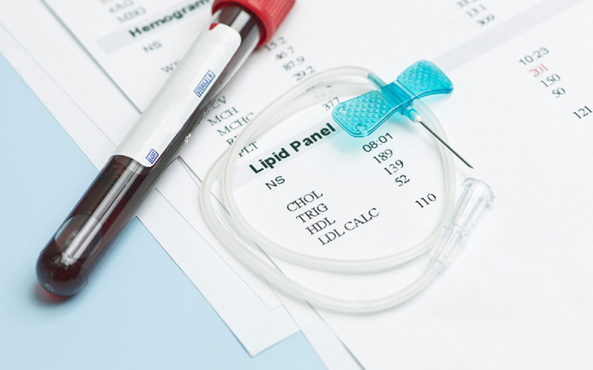 چربی خون بالا در بدن، چه علائم و عوارضی دارد