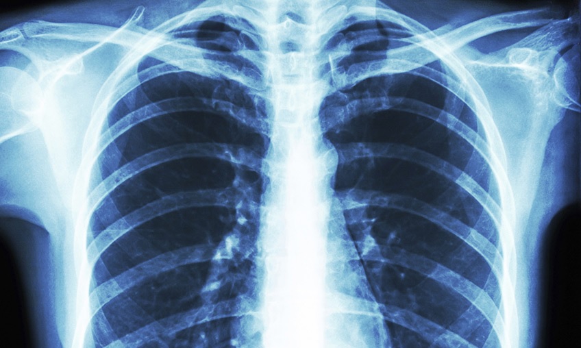 آخرین اخبار مربوط به Covid19 در ایران و جهان