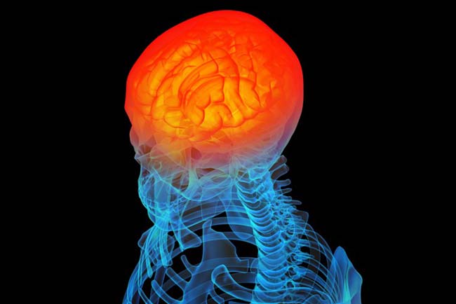 با بیماری آنسفالیت آشنا شوید