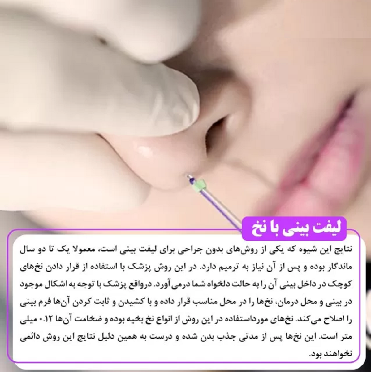 هر آنچه باید درباره ی انواع روش های لیفت و کشیدن پوست بینی بدون جراحی بدانیم